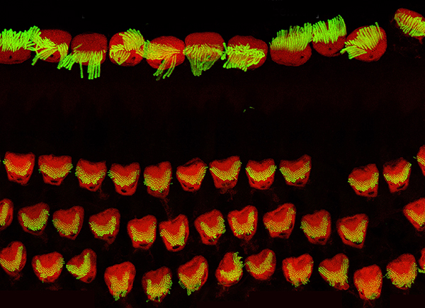 Human cochlea, stereocilia and hair cells imaging - Massachusetts Eye & Ear, MC Liberman