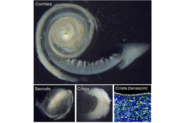 Human inner ear organs imaging - Johns Hopkins U., A. Lauer, Z. Sayyid