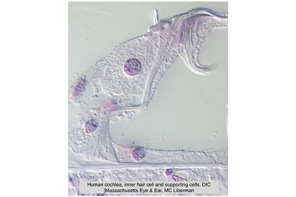 Human cochlea, inner hair cell and supporting cells imaging