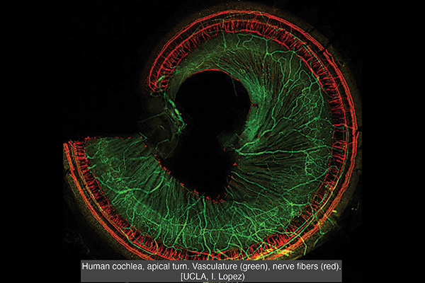 Human cochlea, apical turn. Vasculature (green), nerve fibers (red). UCLA, I. Lopez