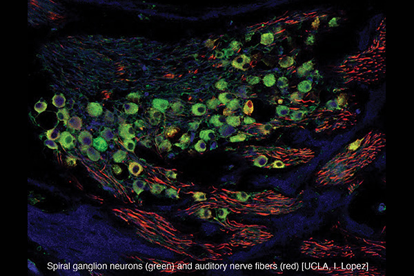 Spiral ganglion neurons and auditory nerve fibers. UCLA, I. Lopez
