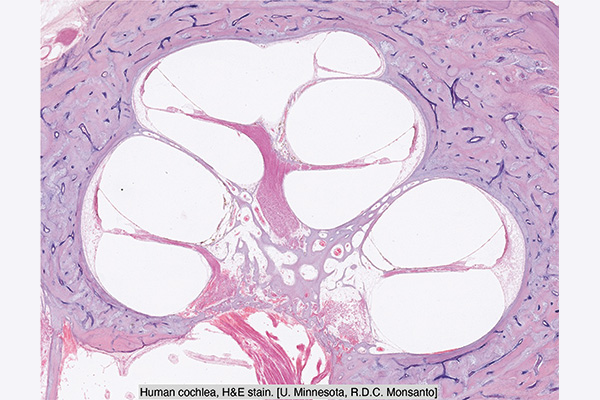 Human cochlea, H&E stain. U Minnesota, R.D.C. Monsanto