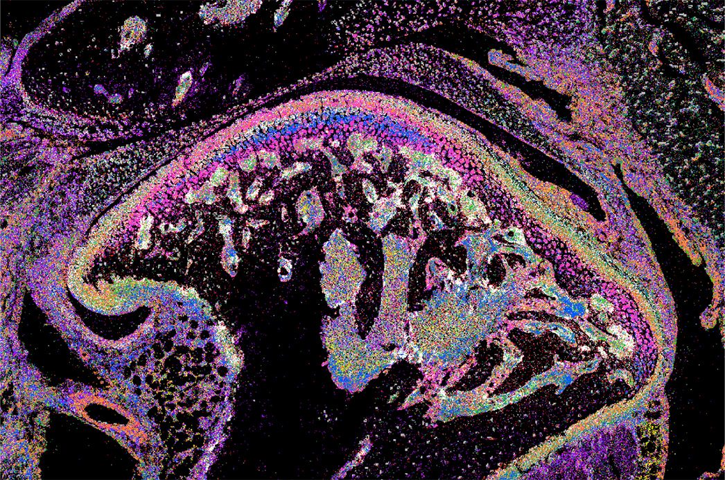 Spatial transcriptomics of the mouse temporomandibular joint (TMJ) using seqFISH