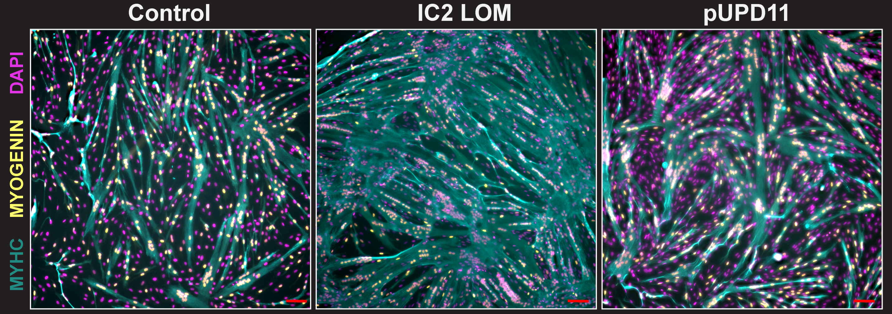 Three fluorescence microscopy panels labeled Control, IC2 LOM, and pUPD11, each showing cultured muscle cells with magenta nuclei, yellow MYOGENIN-positive nuclei, and cyan MYHC-positive muscle fibers.