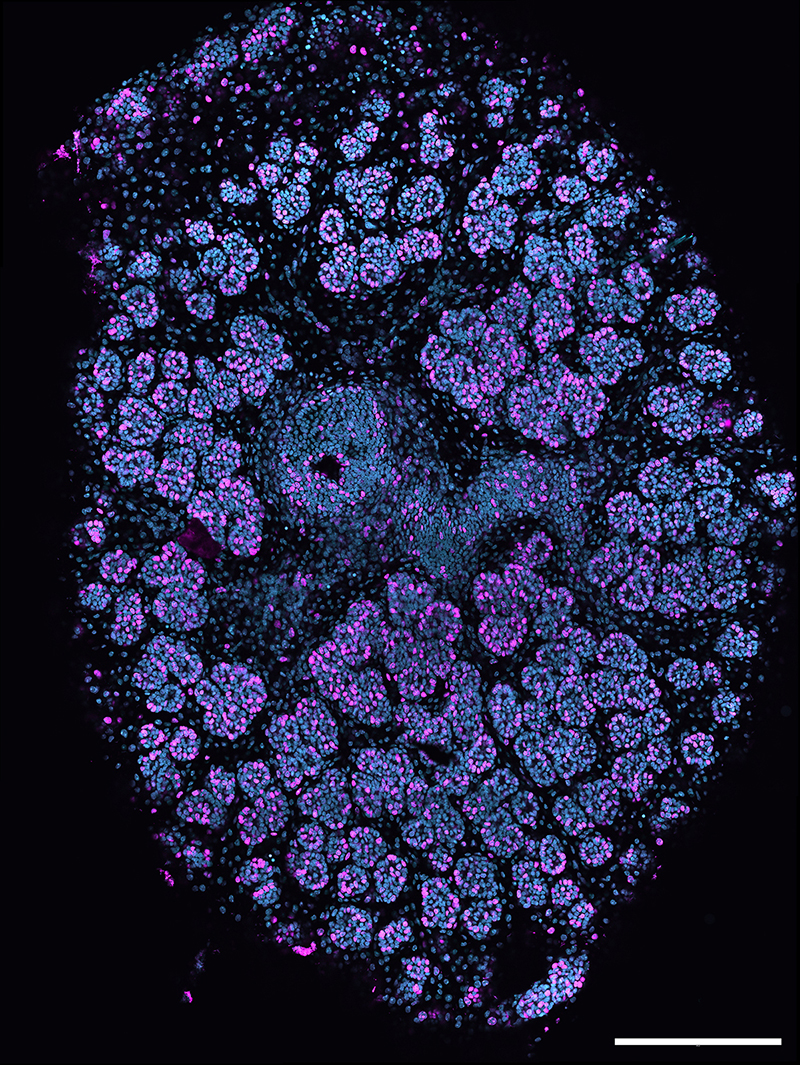 Salivary gland stained with BrdU (proliferative cells, magenta) and DAPI (cyan). Image courtesy of Marta Perera.
