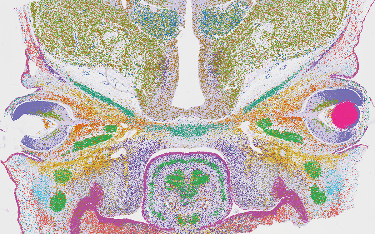 Representative Visium HD spatial transcriptomics image
