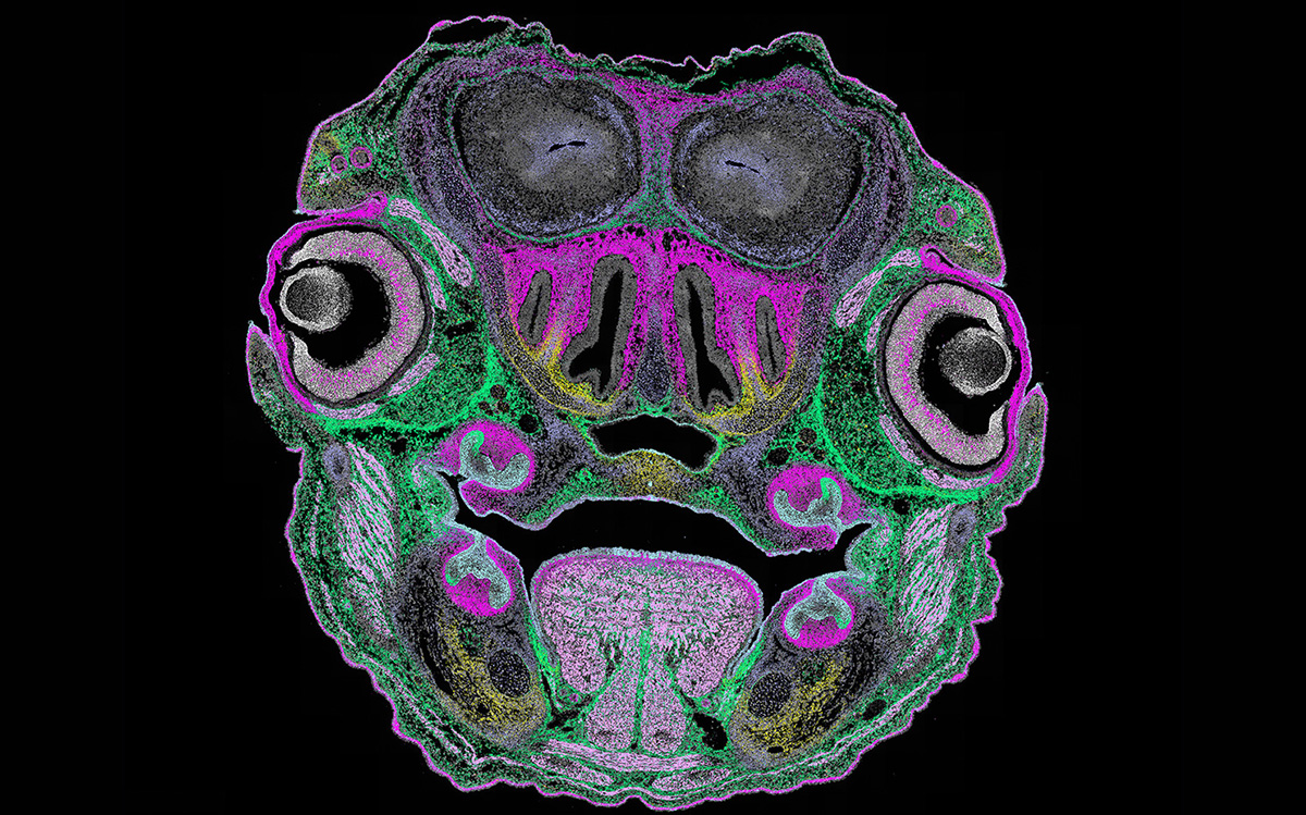 Representative seqFISH spatial transcriptomics image
