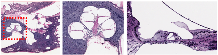 Examples of full resolution H&E scans